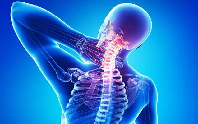 Neck Pain from Accident Injuries 