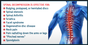 Decompression Therapy by Dr. Gran